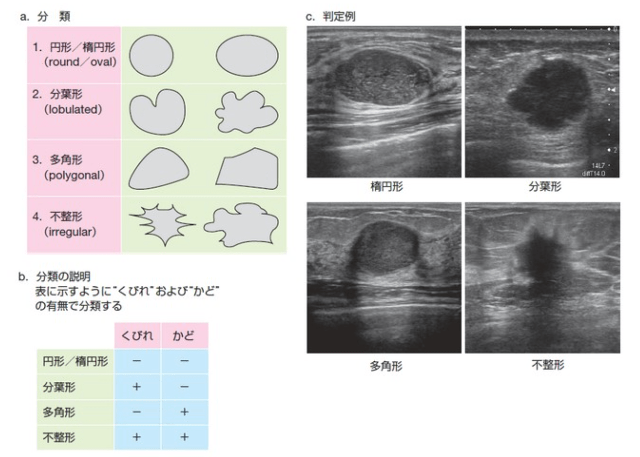 線維腺腫エコー授乳中見えない: 乳腺線維腺腫 見つからなくなる – APTR