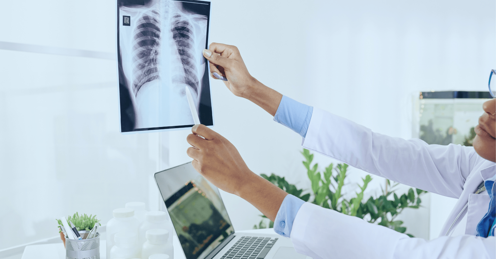 肺がんを調べる胸部レントゲン(X線)検査とは？当日の服装から結果の見方までを解説