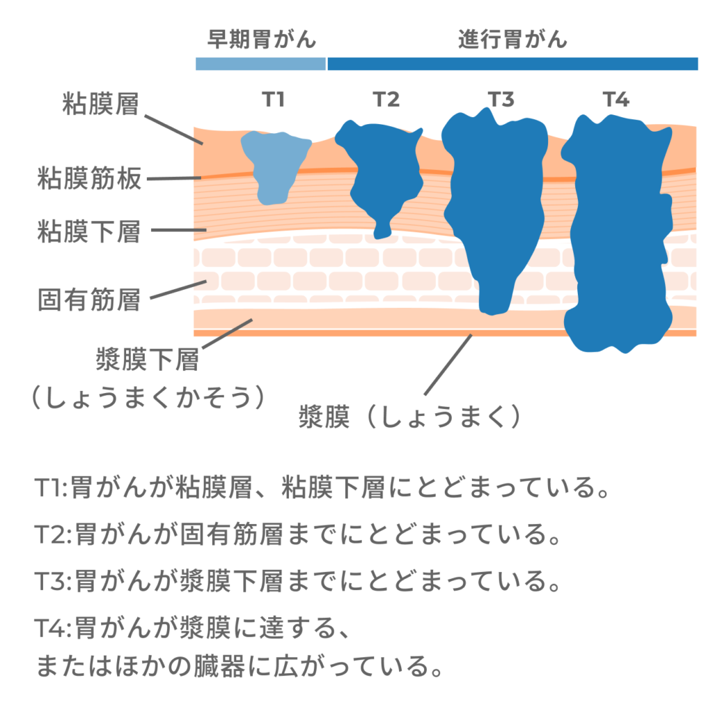 胃がん検査は何歳から?胃がんの症状・検査方法・頻度・費用を解説