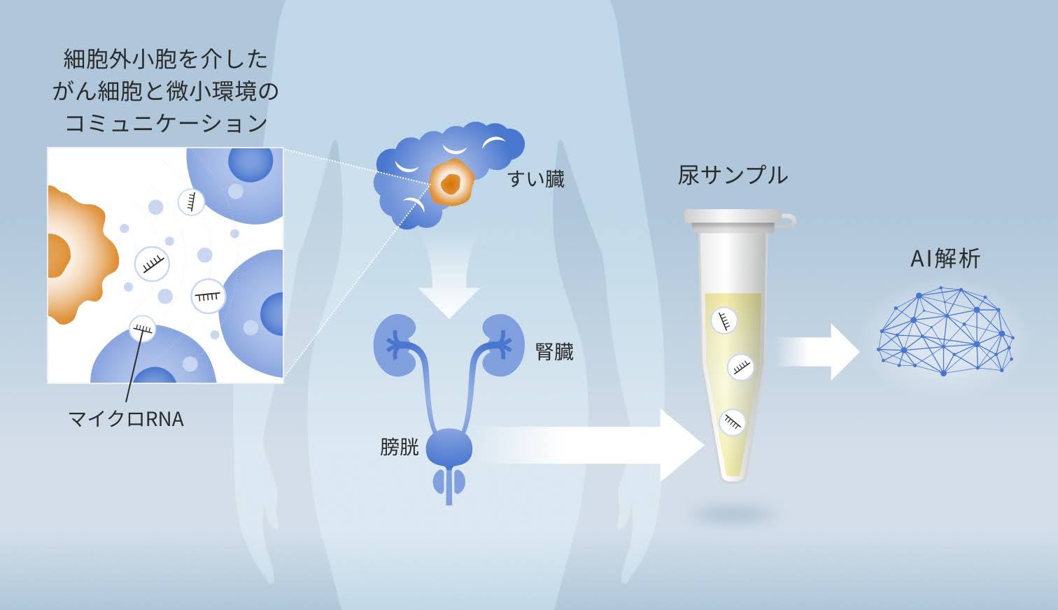 【すい臓がんの早期発見に光】尿のマイクロRNA検査が早期すい臓がんでも優れた検出感度を達成